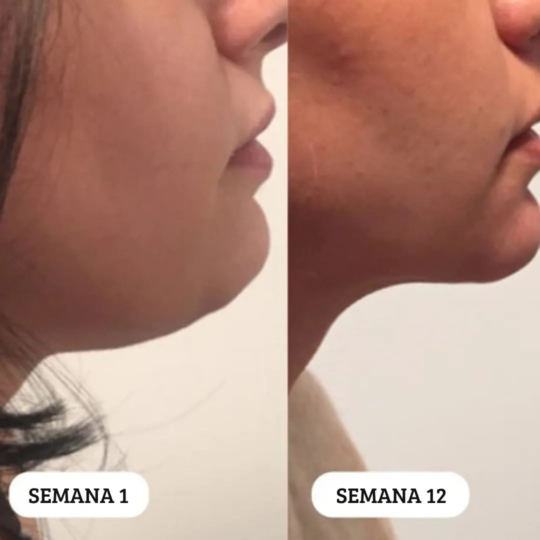 Pendientes LymphVity MagneTherapy